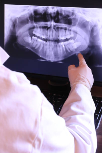 Best Mobile Emergency Dentist in Watsonville, CA