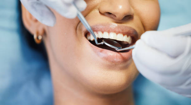 Best Emergency Dentist for Knocked-Out Tooth in Watsonville, CA